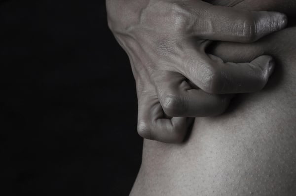 A black and white image of a person with ADHD and skin picking disorder gripping and scratching their skin.